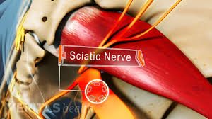 https://www.bestpaindoctornyc.com/wp-content/uploads/2019/01/sciatic-nerve-pain-best-pain-doctor-nyc-03-300x168.jpeg