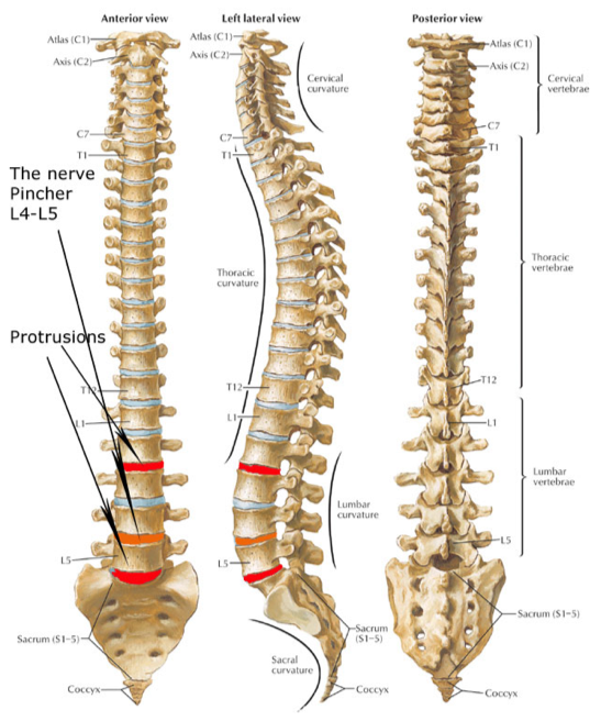 Sciatic nerve pain - spinal diagram nerves 02 - Best Pain Doctor NYC